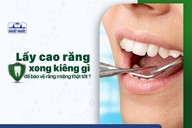 Lấy cao răng xong kiêng gì để bảo vệ răng miệng thật tốt?