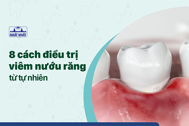 Tiết lộ ngay 8 cách điều trị viêm nướu răng từ tự nhiên
