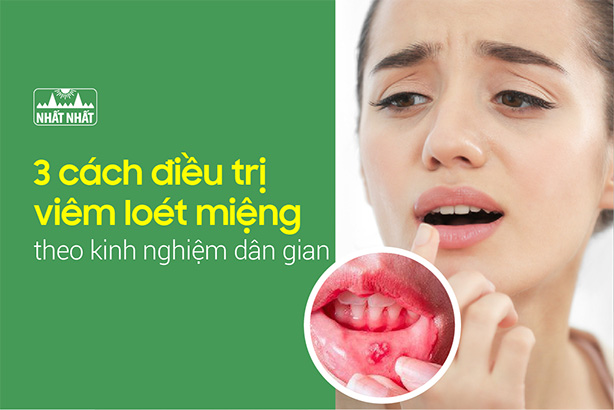 Mách nhỏ 3 cách điều trị viêm loét miệng theo kinh nghiệm dân gian