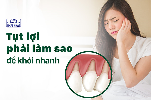 Tụt lợi phải làm sao để khỏi nhanh, bảo vệ răng miệng toàn diện?