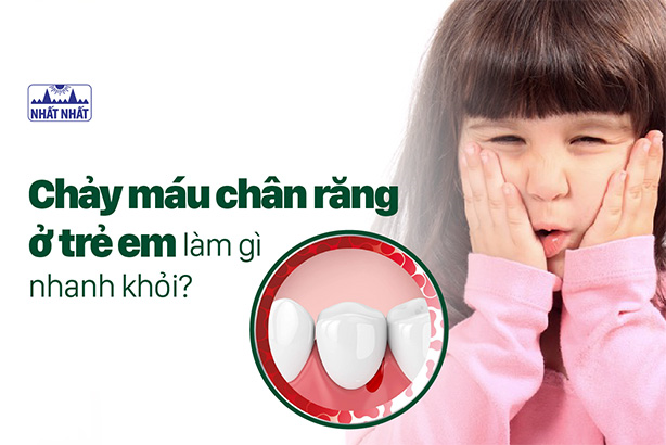 Chảy máu chân răng ở trẻ em làm gì nhanh khỏi?
