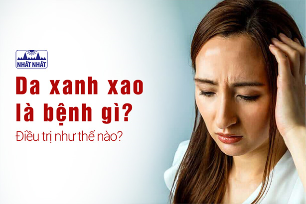 Da xanh xao là bệnh gì? Điều trị như thế nào?