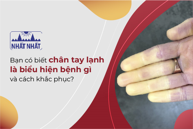 Bạn có biết chân tay lạnh là biểu hiện bệnh gì và cách khắc phục?