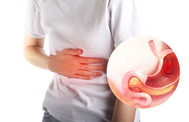 Loét dạ dày triệu chứng cảnh báo cần điều trị ngay!