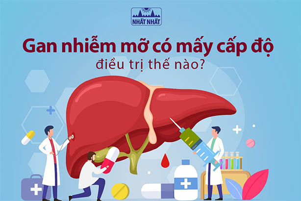 Gan nhiễm mỡ có mấy cấp độ, điều trị thế nào?