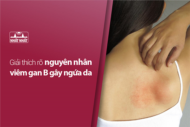 Giải thích rõ nguyên nhân viêm gan B gây ngứa da 