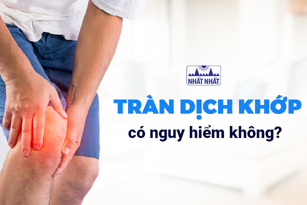Giải đáp: Tràn dịch khớp có nguy hiểm không?