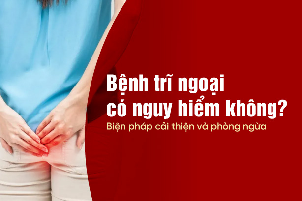 Bệnh trĩ ngoại có nguy hiểm không? Biện pháp cải thiện và phòng ngừa
