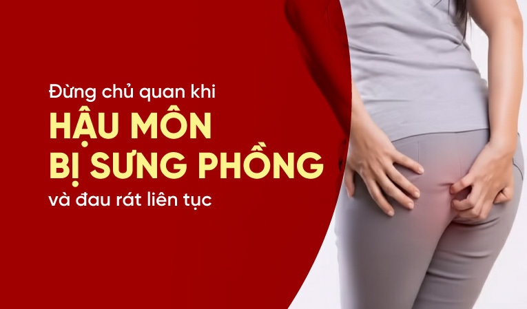 Đừng chủ quan khi hậu môn bị sưng phồng và đau rát liên tục