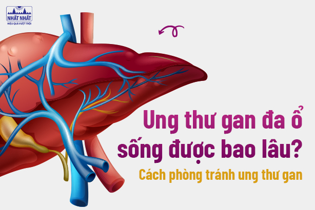 Ung thư gan đa ổ sống được bao lâu? Cách phòng tránh ung thư gan