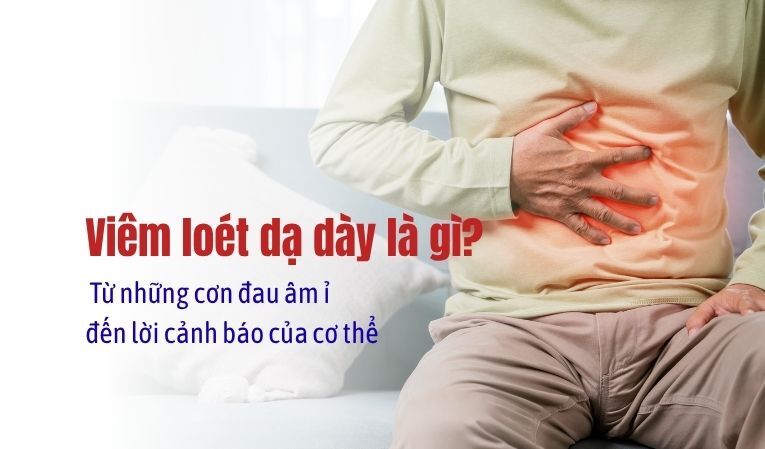 Viêm loét dạ dày là gì? Từ những cơn đau âm ỉ đến lời cảnh báo của cơ thể