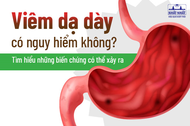 Viêm dạ dày có nguy hiểm không: Tìm hiểu những biến chứng có thể xảy ra