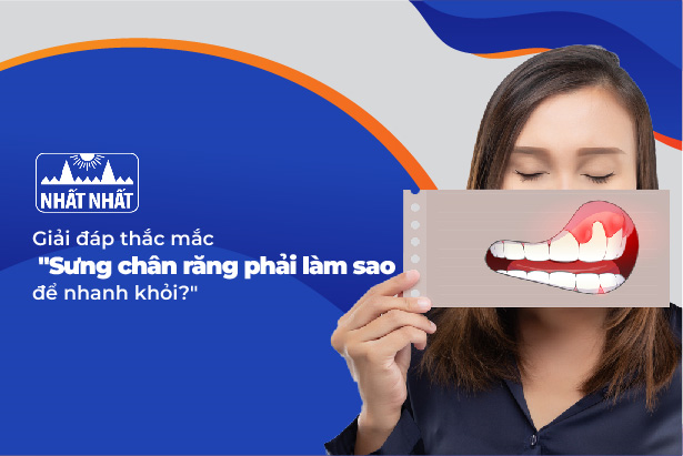 Giải đáp thắc mắc sưng chân răng phải làm sao để nhanh khỏi?