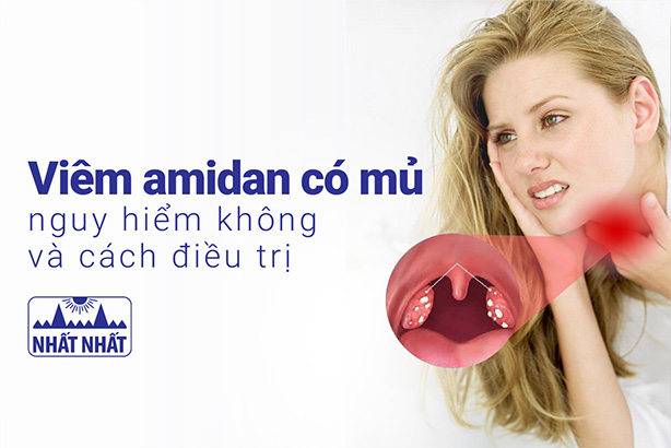 Viêm amidan có mủ nguy hiểm không? Nhận biết và điều trị như thế nào?