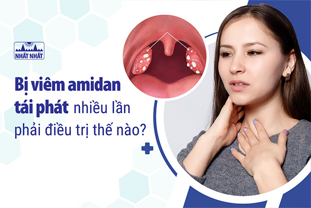 Làm thế nào để phòng ngừa viêm amidan tái phát nhiều lần?
