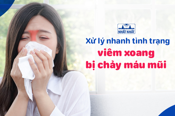 Xử lý nhanh tình trạng viêm xoang bị chảy máu mũi 