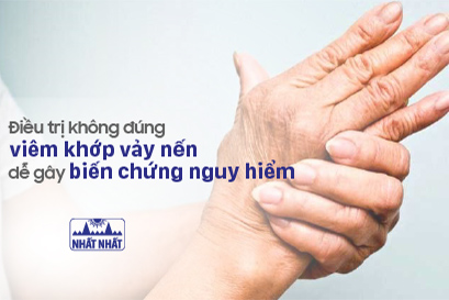 Điều trị không đúng viêm khớp vảy nến dễ gây biến chứng nguy hiểm