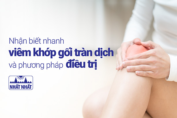 Nhận biết nhanh viêm khớp gối tràn dịch và phương pháp điều trị
