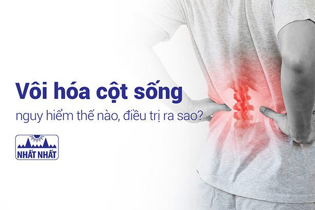 Vôi hóa cột sống nguy hiểm thế nào, điều trị ra sao?