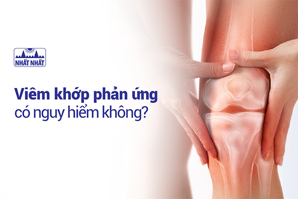 Giải đáp thắc mắc “Viêm khớp phản ứng là gì, có nguy hiểm không?”