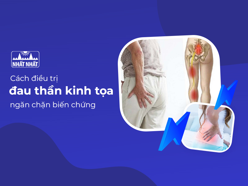 Đau thần kinh tọa và cách điều trị, ngăn chặn biến chứng