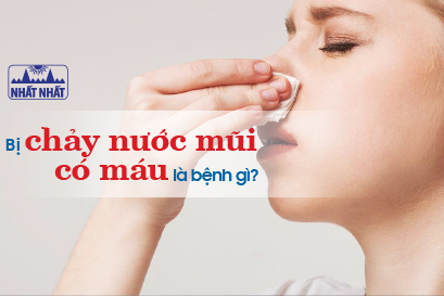 Triệu chứng xì mũi ra máu có thể là dấu hiệu của bệnh nào nghiêm trọng?

