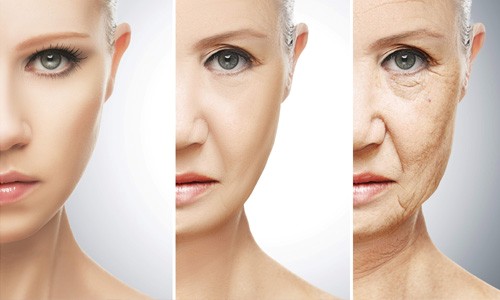 Tuổi tác tăng lên khiến cho làn da bị lão hóa dần trở nên mỏng hơn kém đàn hồi